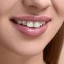 teeth whitening 112x90
